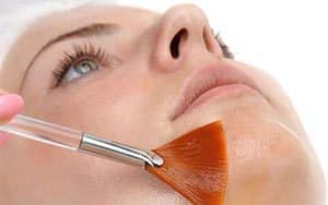 Peeling de mésoesthétic